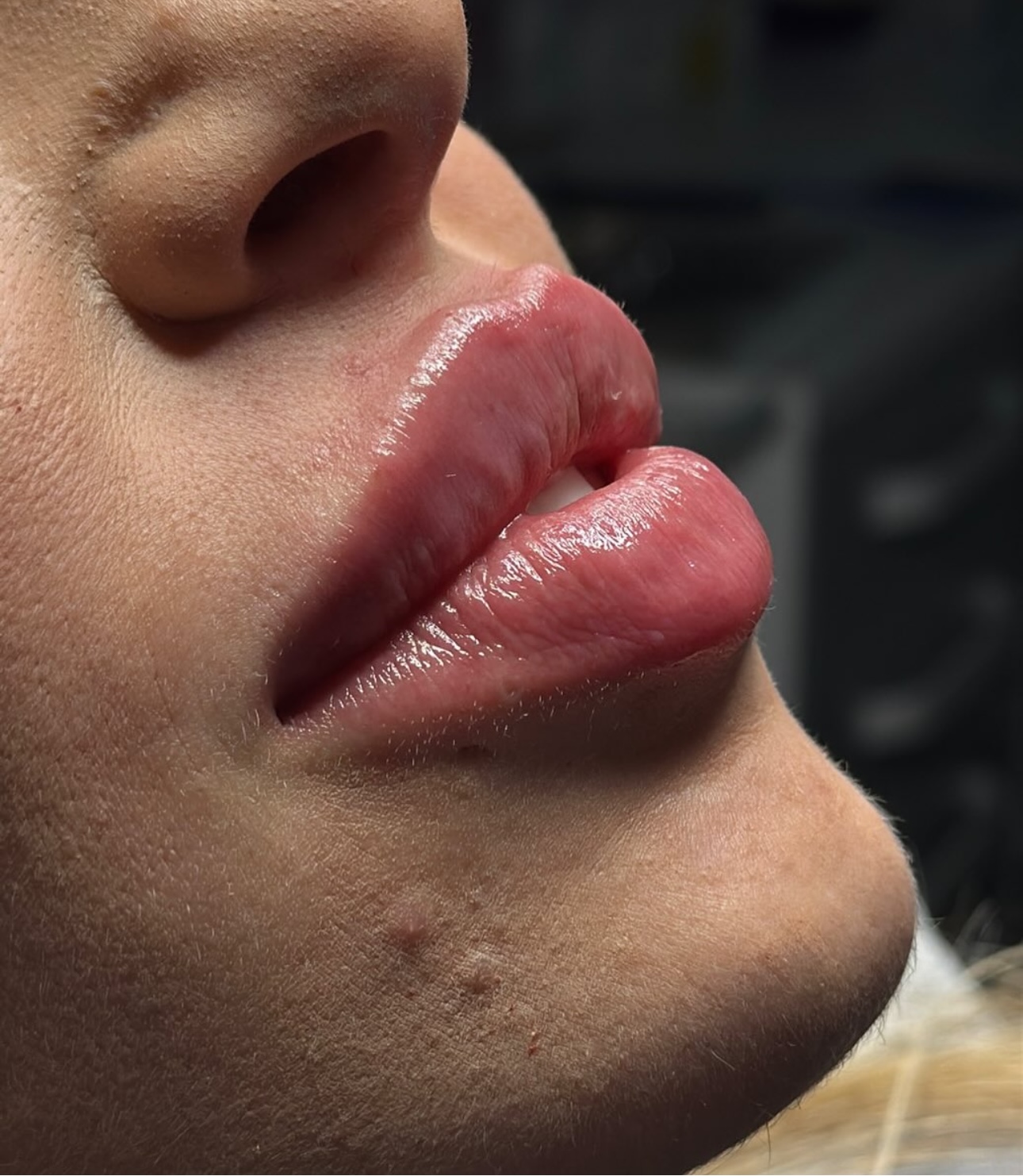 Lip'sculpting